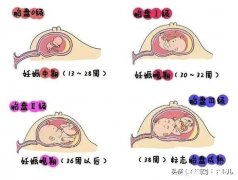孕29周+2检查胎盘成熟度2级，会不会宝宝比预产期提前出来