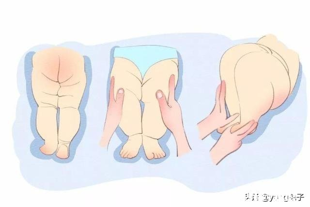 三个月宝宝腿纹不对称，对身体发育有影响吗需要做髋关节彩超筛查吗