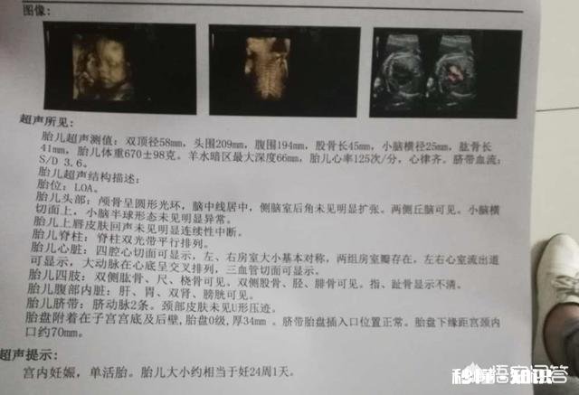 孕期的NT检查跟四维彩超都是必做的检查项目吗