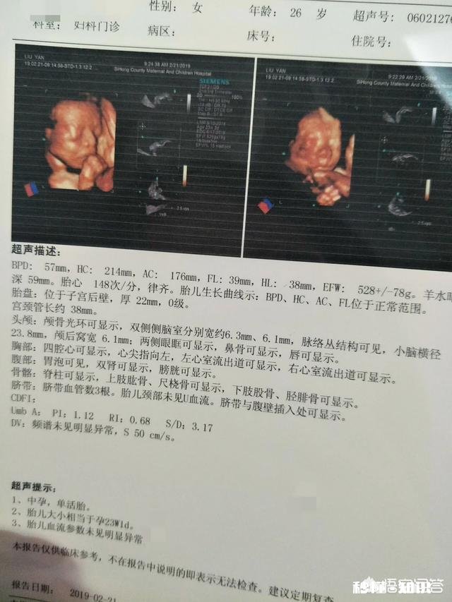 孕期的NT检查跟四维彩超都是必做的检查项目吗