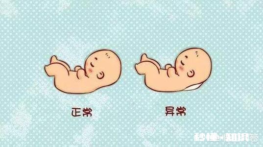 孕期的NT检查跟四维彩超都是必做的检查项目吗