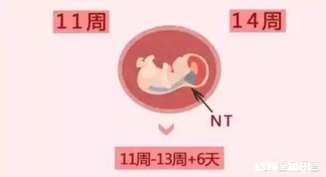 孕期的NT检查跟四维彩超都是必做的检查项目吗