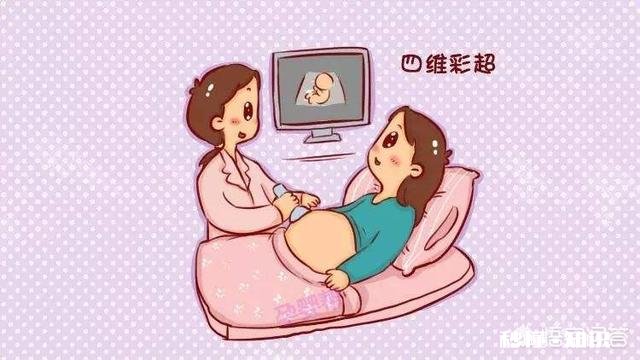 孕期的NT检查跟四维彩超都是必做的检查项目吗