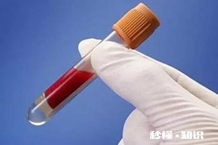 痛风需要做哪几项检查