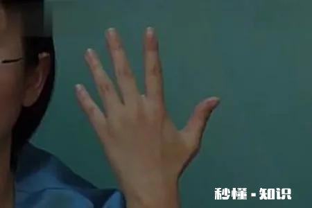 什么是类风湿病