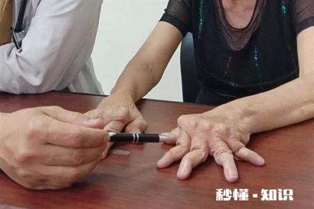 什么是类风湿病