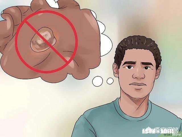 脚下长老茧怎么办