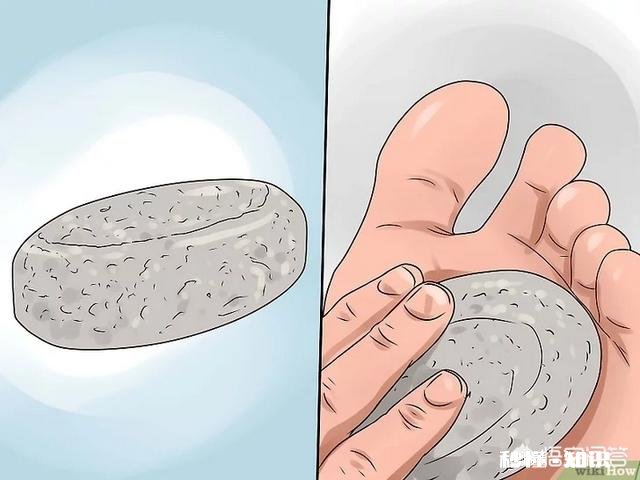 脚下长老茧怎么办