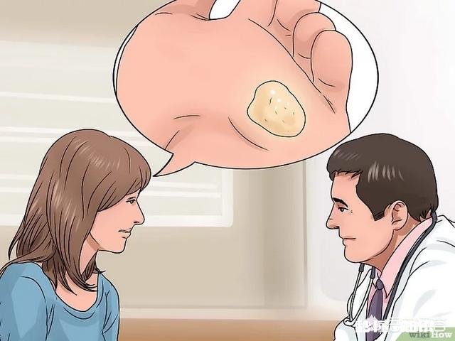 脚下长老茧怎么办