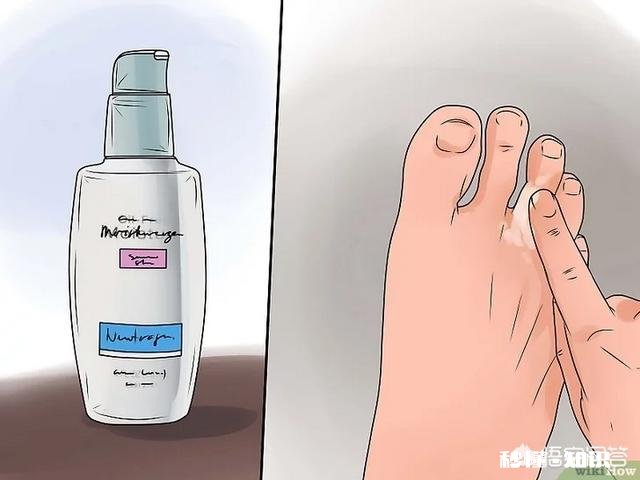 脚下长老茧怎么办