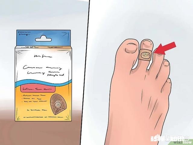 脚下长老茧怎么办