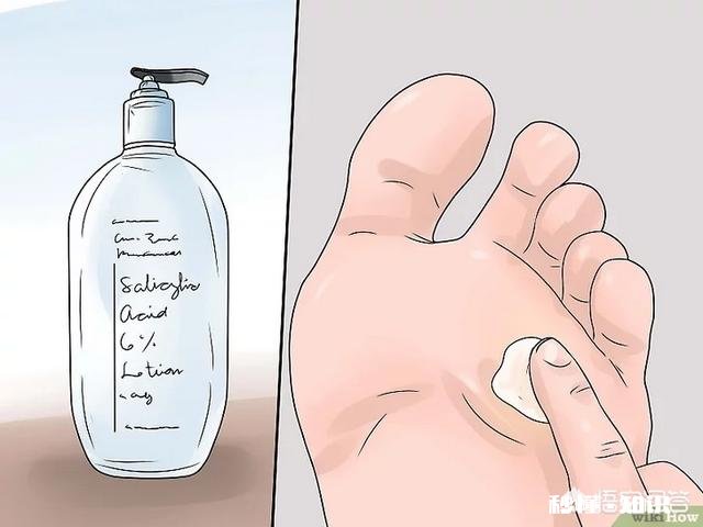 脚下长老茧怎么办