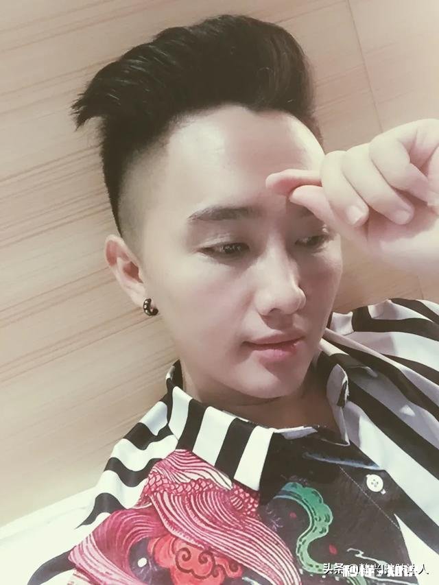 脸上为什么会出现红血丝呢