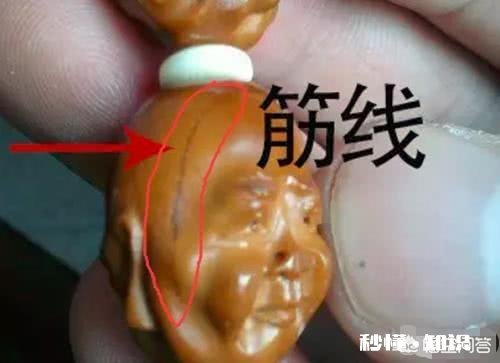 橄榄核白筋可以盘掉吗