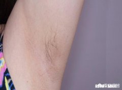 女生液下有毛需要拔吗