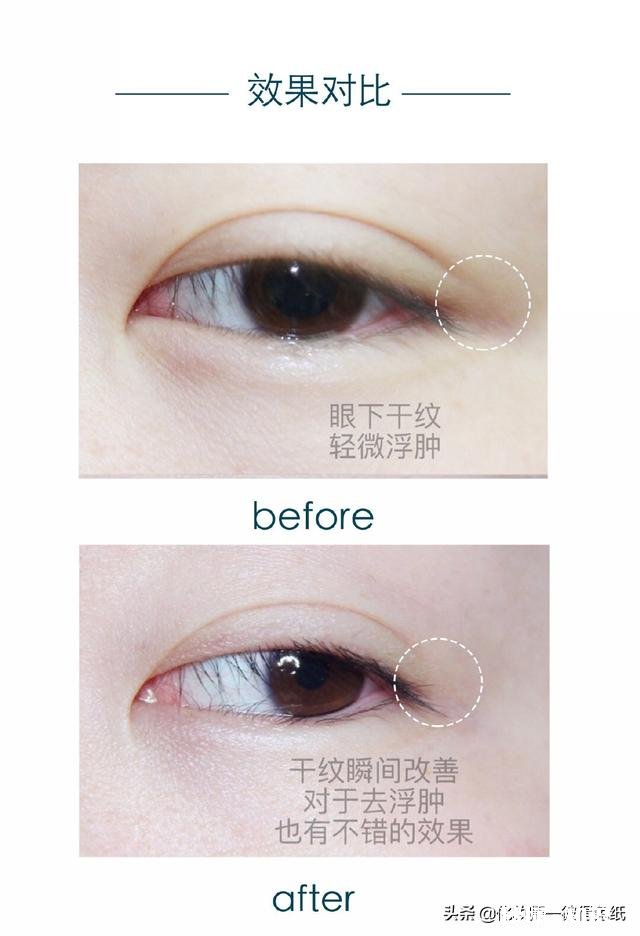 兰蔻的大眼精华都有哪些功效效果怎么样