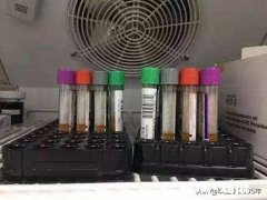 检验科与患者都有哪些有趣的事