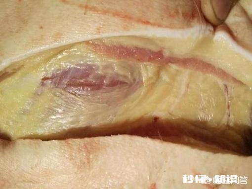 “黄膘猪形成的原因是什么，其肉真不能食用吗