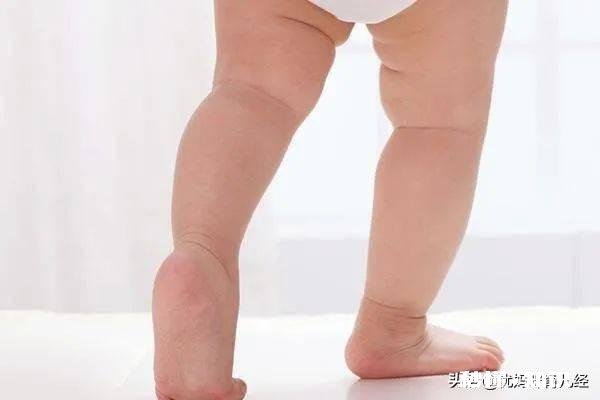 四个月宝宝的腿纹还是不对称，该怎么办啊