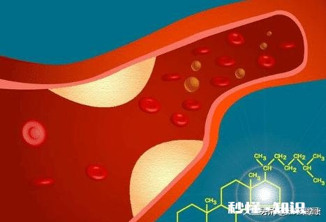 脑血栓后遗症患者身体到处疼痛吗
