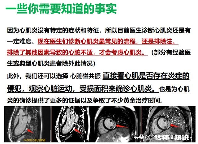 感冒后心悸,无器质性病变。是心肌炎后遗症还是心脏神经官能症