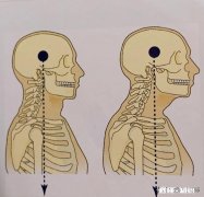 颈椎不舒服坐车会晕车吗