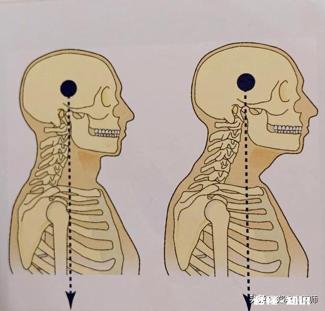 颈椎不舒服坐车会晕车吗