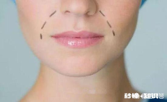 害怕法令纹会暴露年龄，怎么改善令人讨厌的法令纹