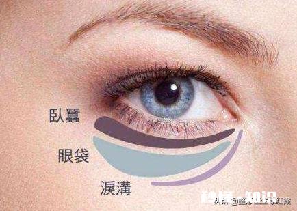 怎么判断自己的是卧蚕还是眼袋