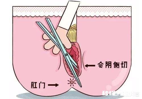 有人说比产痛更让妈妈们恐惧的是会阴侧切，为啥多数顺产都要挨一刀