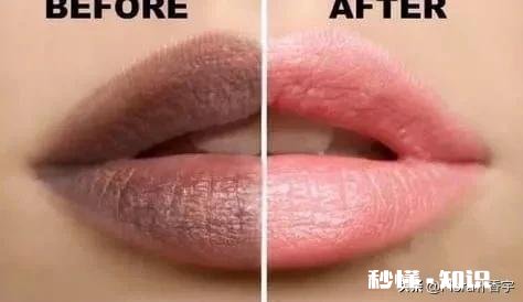 唇色暗淡无光而且死皮比较多怎么办用什么产品可以解决
