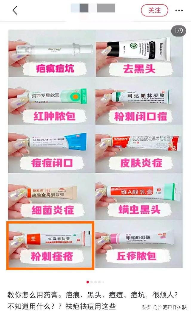 油皮痘肌怎样改善