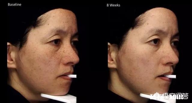 怎样才能做到素颜也好看