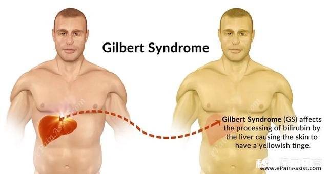 胆红素跟皮肤痒的关系是怎样的
