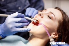 有哪些快速美白牙齿的方法