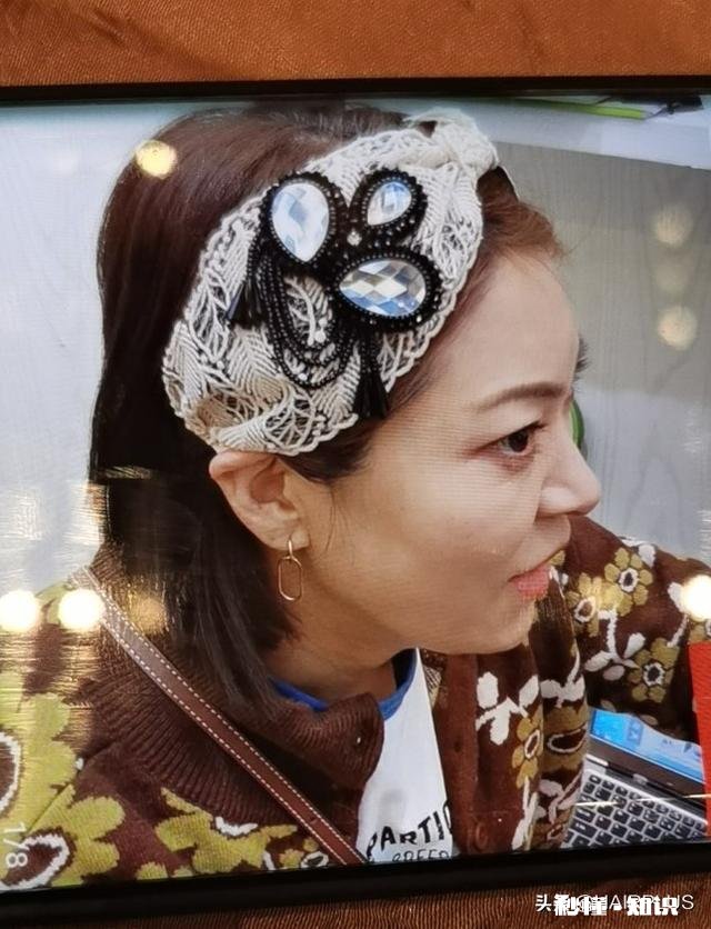 头顶头发稀疏，有办法挽救吗