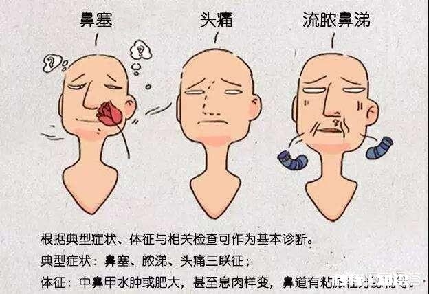 儿童鼻窦炎需要吃抗生素吗