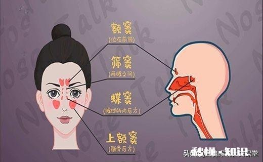 儿童鼻窦炎需要吃抗生素吗