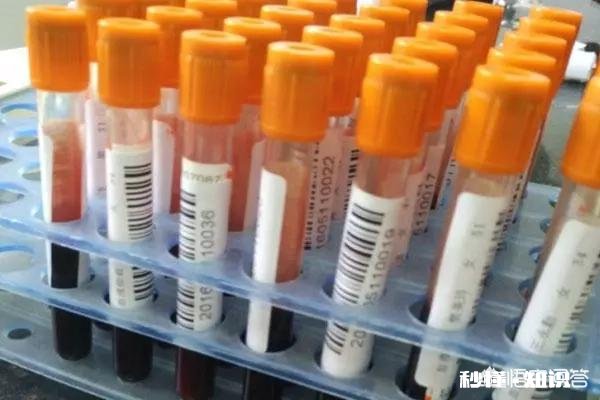 抽血化验是不是能把所有科需要化验的都能化验出来