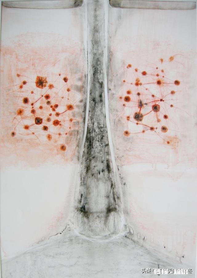 红血丝如何祛除