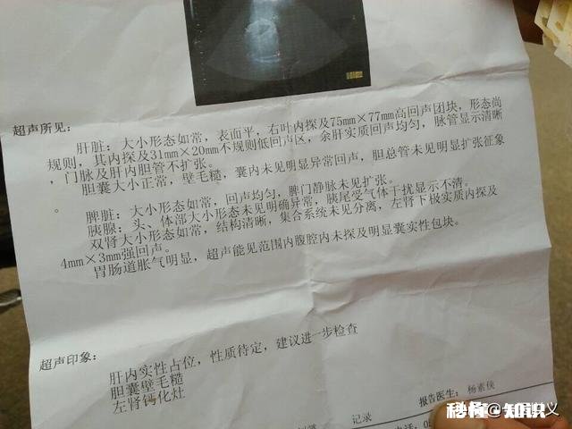 肝癌术后患者很容易复发吗