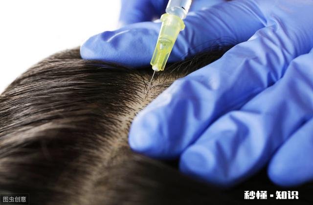 头发掉的比以前多，怎么办