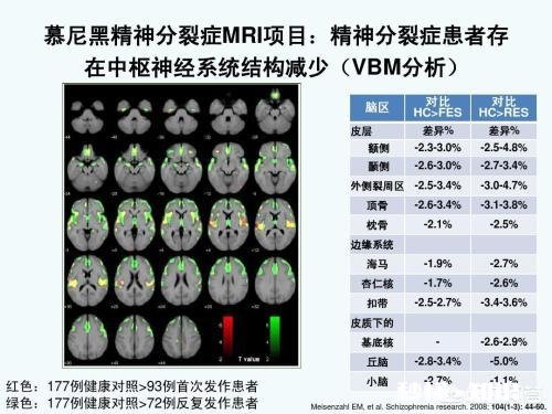 精神分裂症每犯一次都会伤害一次大脑吗