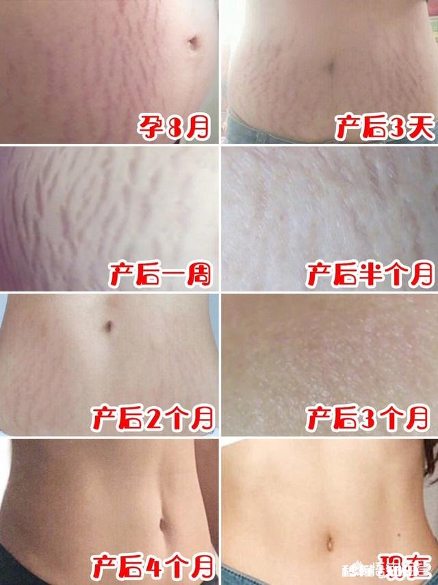 大家有什么产后瘦身的经历