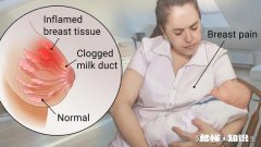 哺乳期，胸部有硬块而且疼痛，宝宝吸不出来不愿意吃了，催乳师都揉不开，还有什么办法