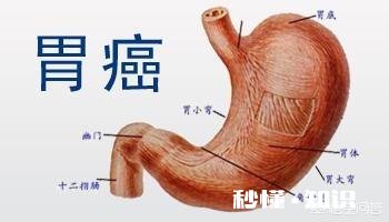 80%的胃癌发现时已是晚期，如何才能早发现