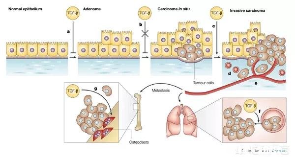 为什么灵芝有抗癌的功效