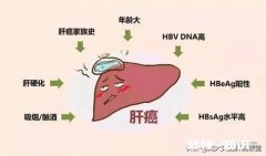 为什么说90后是肝癌的高危人群具体有哪些因素