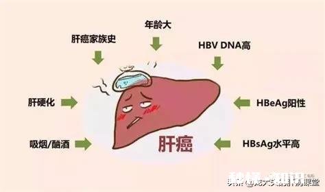 为什么说90后是肝癌的高危人群具体有哪些因素