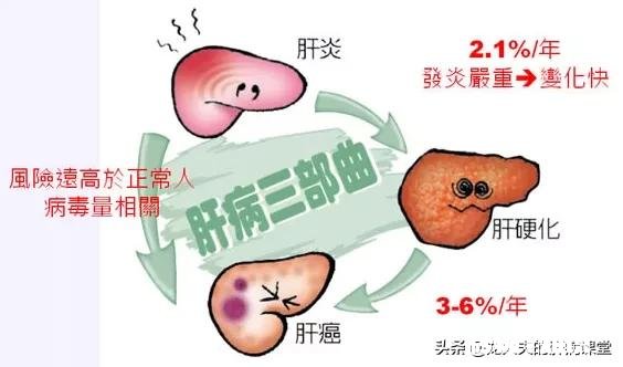 为什么说90后是肝癌的高危人群具体有哪些因素